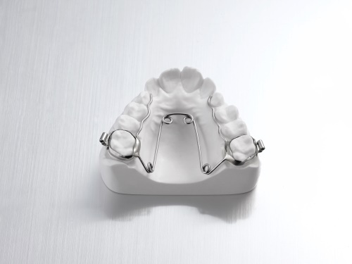 Quad Helix with lingual cleats