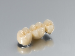 Porcelain Fused to Metal (PFM) Bridge Crown Wholesale Supplier | SUNRISE