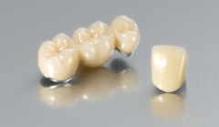 Porcelain Fused to Metal (PFM) Bridge Crown Wholesale Supplier | SUNRISE