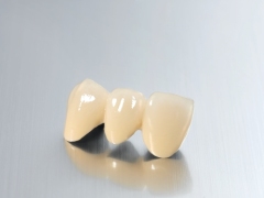 Porcelain Fused to Metal (PFM) Bridge Crown Wholesale Supplier | SUNRISE