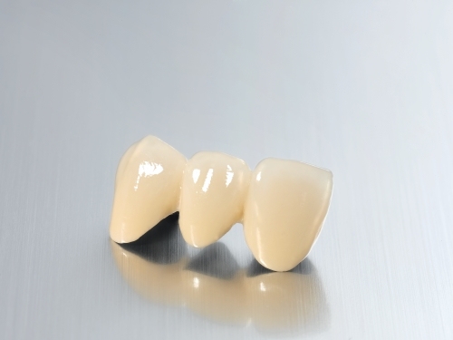 Porcelain Fused to Metal (PFM) Bridge Crown Wholesale Supplier | SUNRISE
