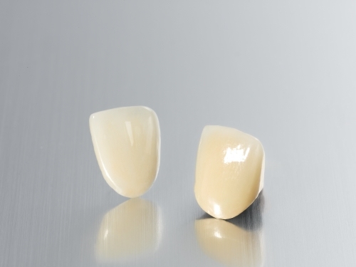 Porcelain Fused to Metal (PFM) Bridge Crown Wholesale Supplier | SUNRISE