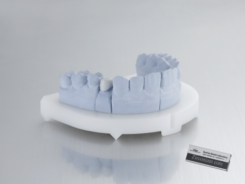 Zirconia Coping