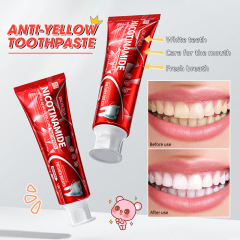 OEM Natural Herbal Oral Care Niacinamide Whitening Baking Anti Yellow Clean Purify Toothpaste Teeth Paste Toothpaste