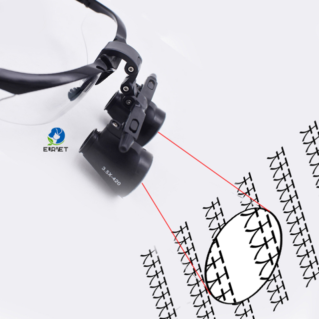 EUR PET Best Quality One-way Screw Thread Loupe Medical Device Mobile Operating System