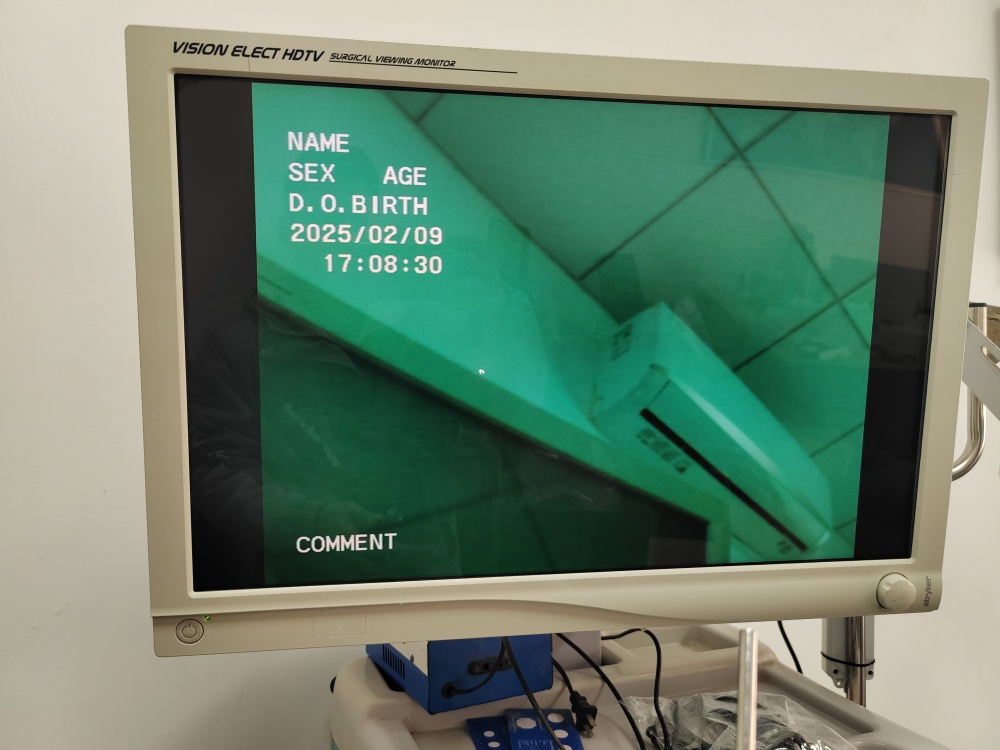 Olympus WA50021B 5mm 0° SD Visera EndoEYE Video Laparoscope