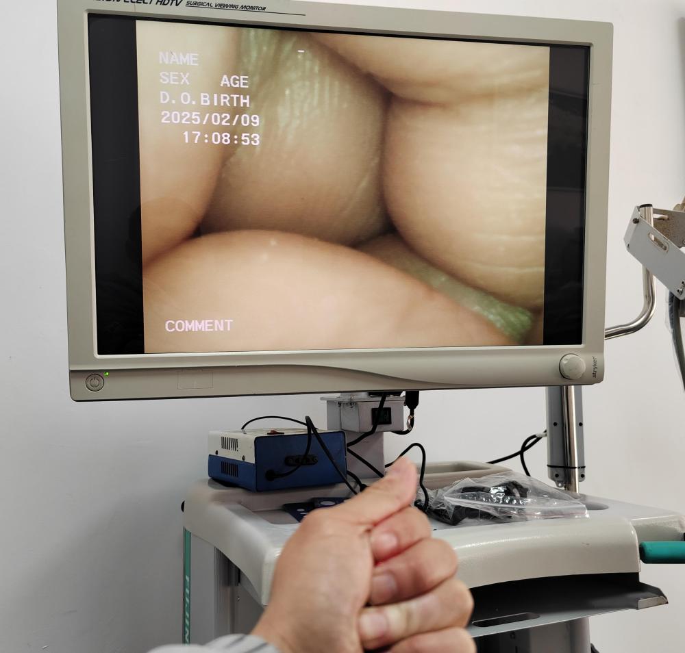 Olympus WA50021B 5mm 0° SD Visera EndoEYE Video Laparoscope