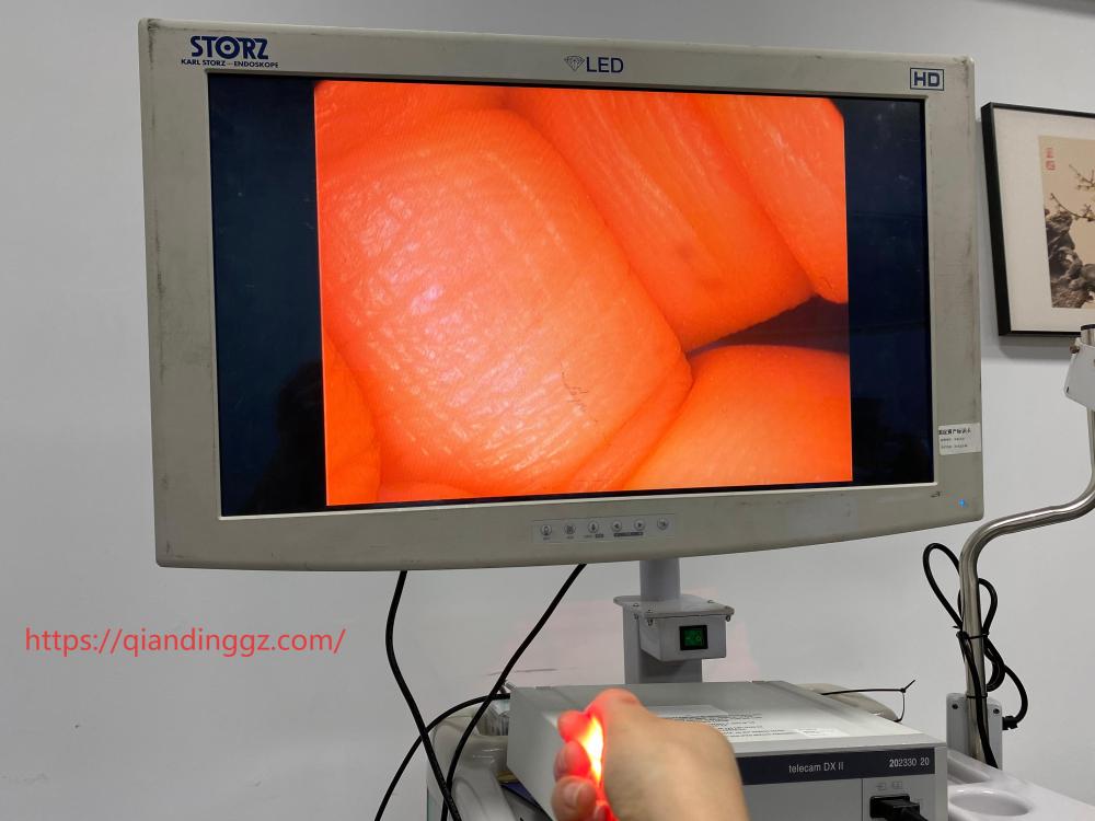 Live image test of Stryker Ideal Eyes laparoscope showing clear optics on monitor