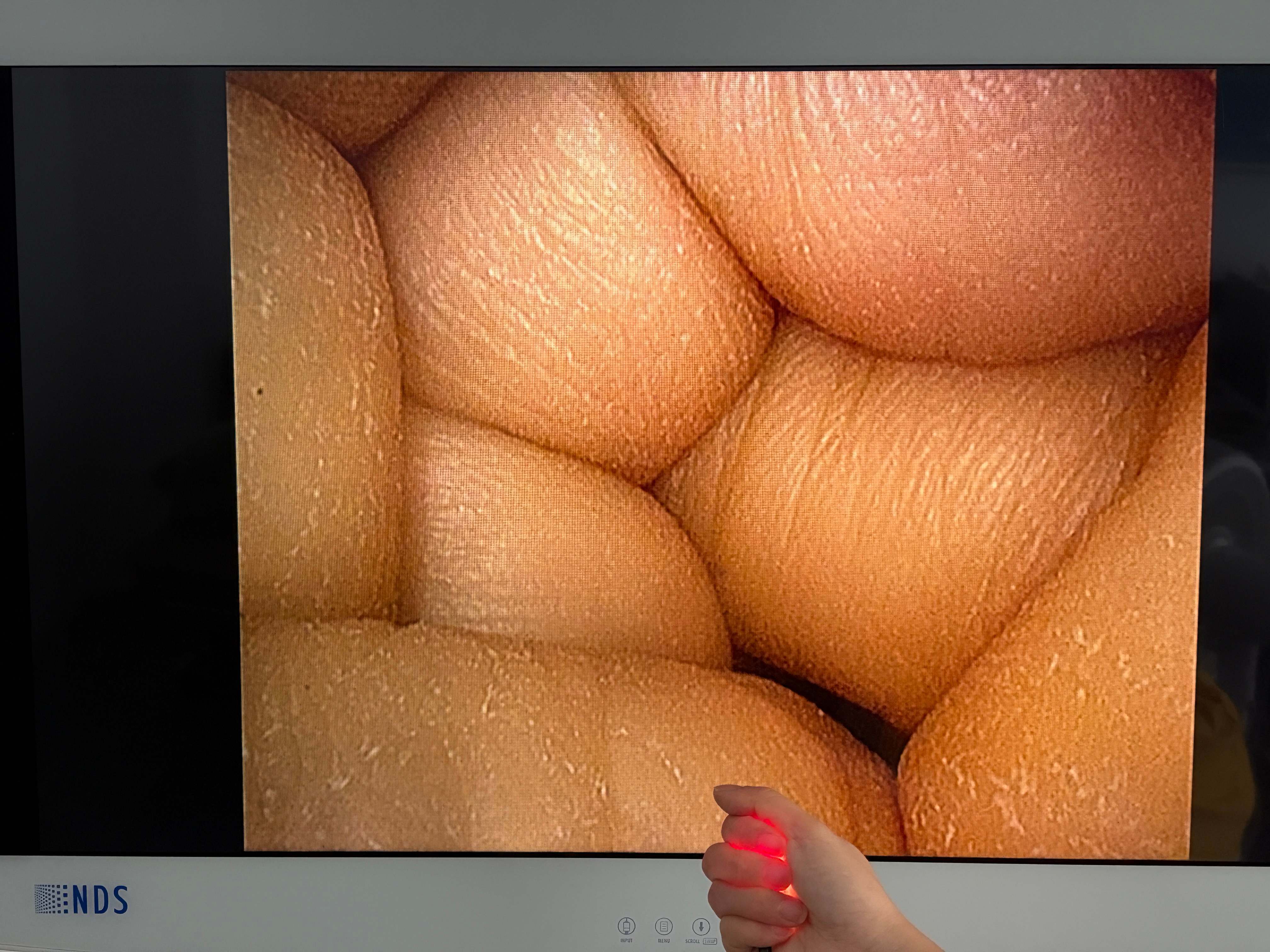 Live test image output of Olympus CYF-VH NBI flexible cystoscope on monitor