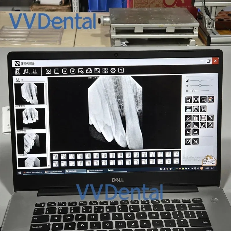 VVDENT Refine Sensor USB Connection Computer Imaging System Multi-Model Oral Digital Imaging Refine Sensors R1 R2 China