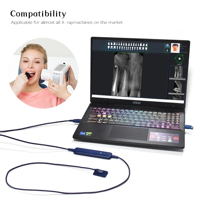 VVDen X-ray  Sensor  Fast Transmission Digital USB Connection Computer Imaging System Blue RX Dental Photography Sensor