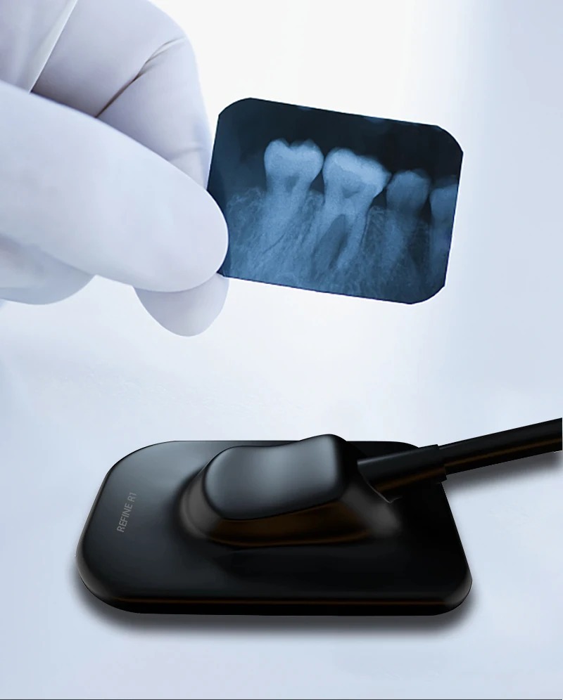 VVDENT Refine Sensor USB Connection Computer Imaging System Multi-Model Oral Digital Imaging Refine Sensors R1 R2 China