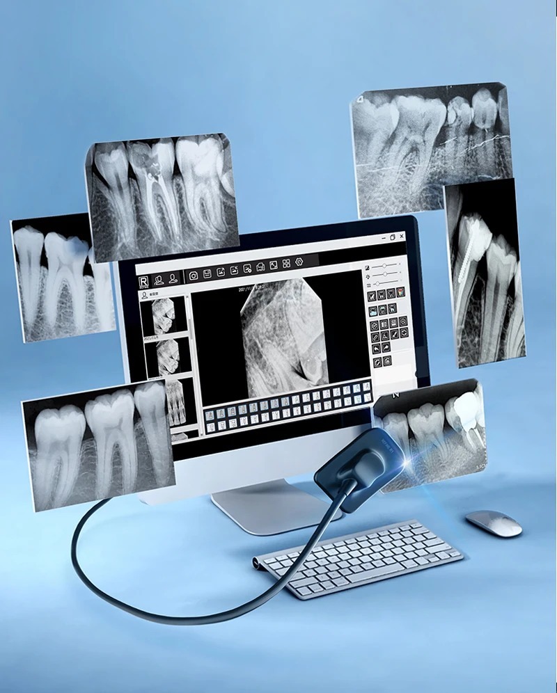 VVDENT Refine Sensor USB Connection Computer Imaging System Multi-Model Oral Digital Imaging Refine Sensors R1 R2 China