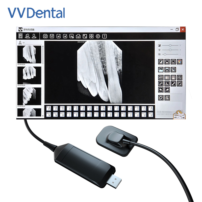 VVDENT Refine Sensor USB Connection Computer Imaging System Multi-Model Oral Digital Imaging Refine Sensors R1 R2 China