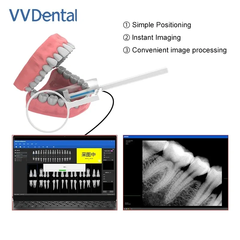 VV Dental Sensor Dental Fluoroscopy Exposure Plate High Definition Lmage Fast Transmission Digital Computer Imaging System eco2