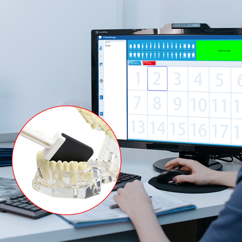 VVDental Ruixin Dental Imaging Sensor - USB High-definition Images with Complete Installation Files and Visual Tutorial