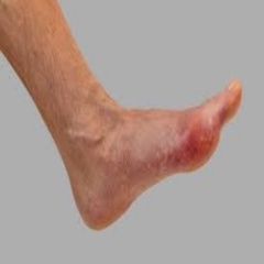 Leg Hair