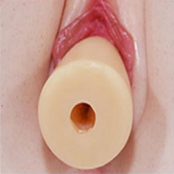 Removable