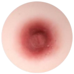 #03