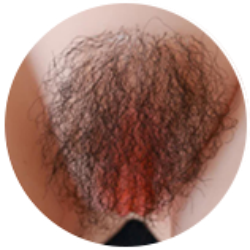 #03