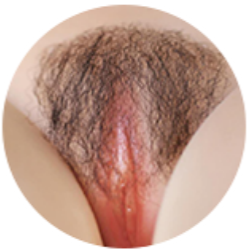 #04