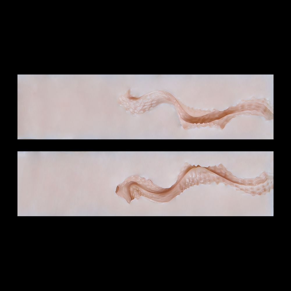 05-11.3cm