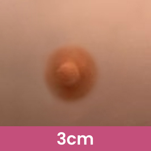 3CM