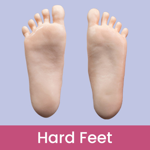 Hard-Feet