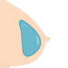 Gel Breasts