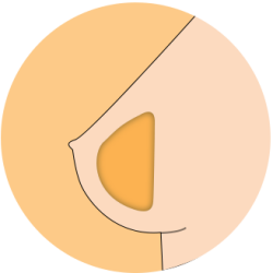 Soft Gel Breasts