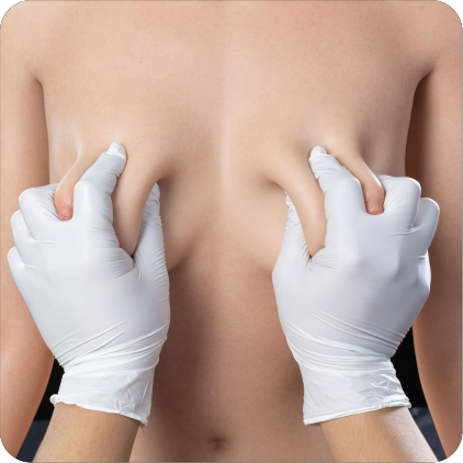 Gel Breasts