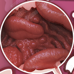 Tongue Fantasy