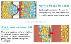 Factory hot sales Modern design cryo 360 fat portable slim body cryo machine for home use