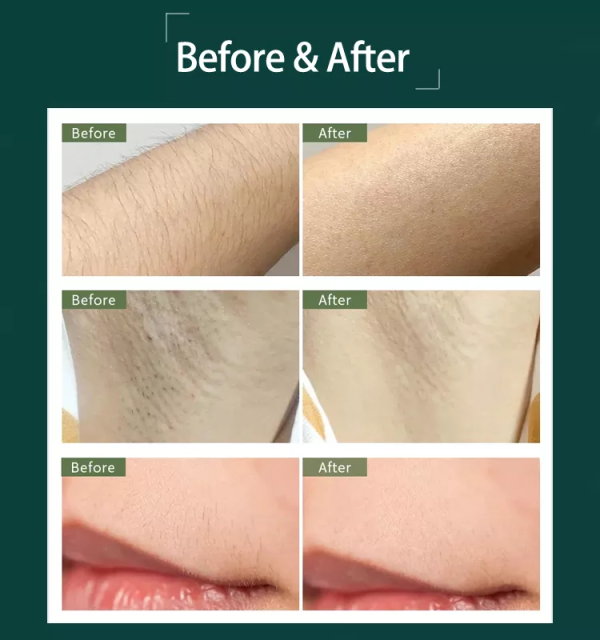 Drop Shipping Home Use 5th Gear Quartz Tube Mini Hair Removal Appliances Permanent Ipl Hair Removal Device Handset