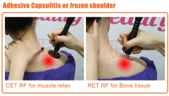 Tecar Therapy Physio Monopolar RF Resistive and Capacitive Machine Tecarterapia Profesional