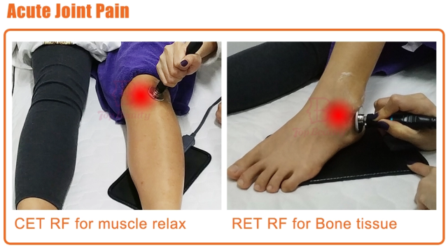 Tecar Therapy Physio Monopolar RF Resistive and Capacitive Machine Tecarterapia Profesional