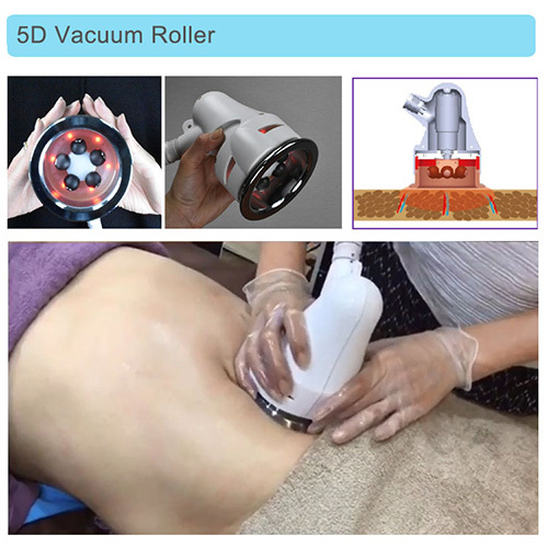 5D vacuum infrared roller cellulite reduction machine