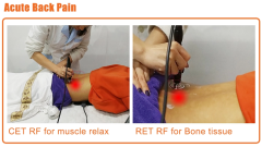 Tecar Therapy Physio Monopolar RF Resistive and Capacitive Machine Tecarterapia Profesional