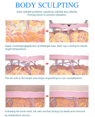 New arrivals 2022 portable cryolipolysis 360 fat freezing cool body sculpting machine / 360 cryolipolisis machine