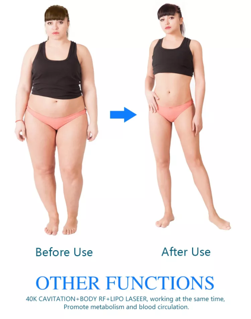 New arrivals 2022 portable cryolipolysis 360 fat freezing cool body sculpting machine / 360 cryolipolisis machine