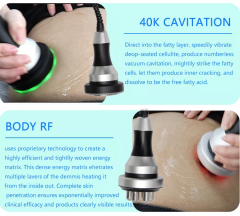 New arrivals 2022 portable cryolipolysis 360 fat freezing cool body sculpting machine / 360 cryolipolisis machine