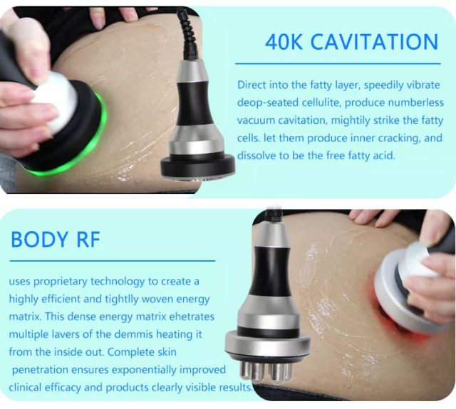 New arrivals 2022 portable cryolipolysis 360 fat freezing cool body sculpting machine / 360 cryolipolisis machine