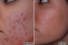 double treatment flat PDT Photon Light Facial Therapy 7 Colors LED Facial Light Therapy Beauty Device