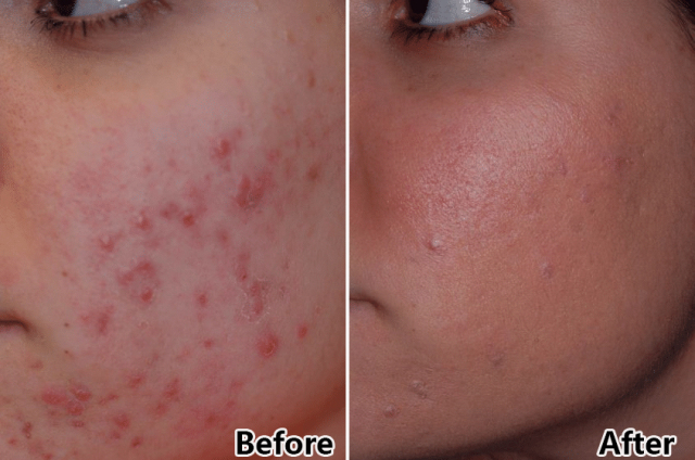 double treatment flat PDT Photon Light Facial Therapy 7 Colors LED Facial Light Therapy Beauty Device