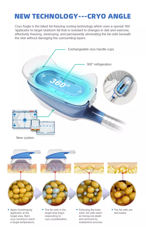 2022 360 Cryo Machine Cryolipolysis Best Price Fat Freezing Machine For Weight Loss Cryolipolysis