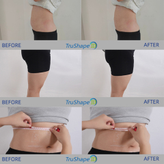 Trushape ID Treatment Ems Electrical Muscle Stimulation Body Sculpting Emslim Machine