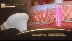 2023 New VDHF rf radio high frequency skin tightening machine best wrinkle remover equipment beauti lifting face care product