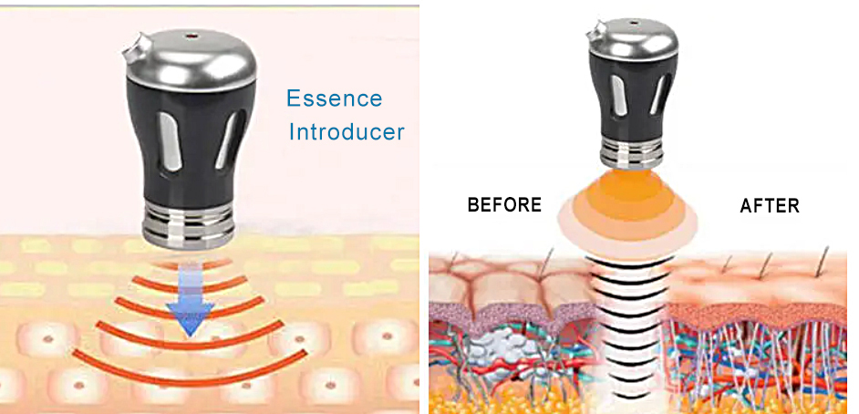 2 in 1 RF Beauty import Device EMS beauty product Machine anti aging face lift device wrinkles remove Ultrasound EMS Therapy Machine