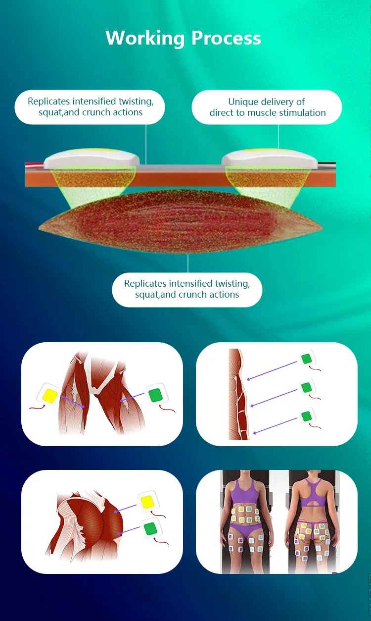 Trufat Slimming BCM Thermal Sculpt Monopolar RF double chin slimming body shaping machine
