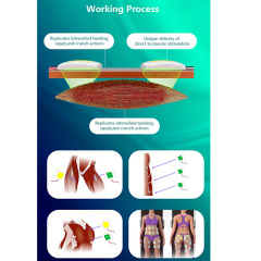 professional Trusculpt ID EMS electrical muscle stimulation body shape Machine